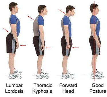 Examples of good and bad posture