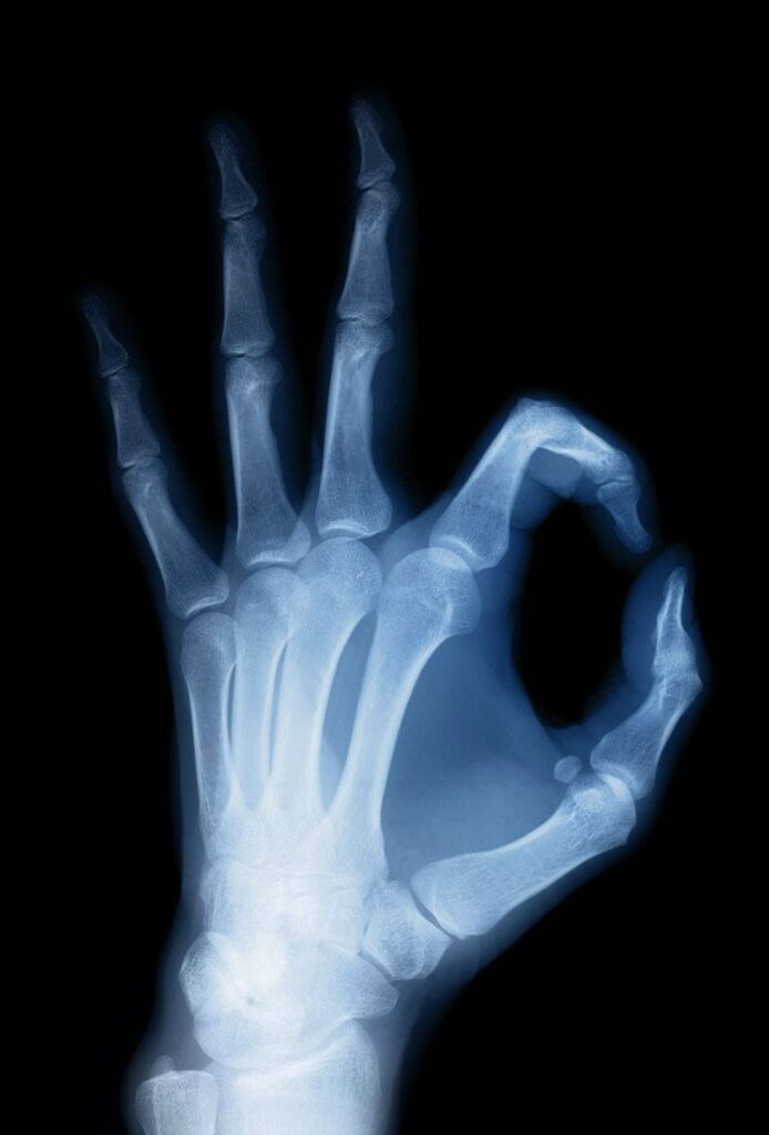 X-ray of a hand